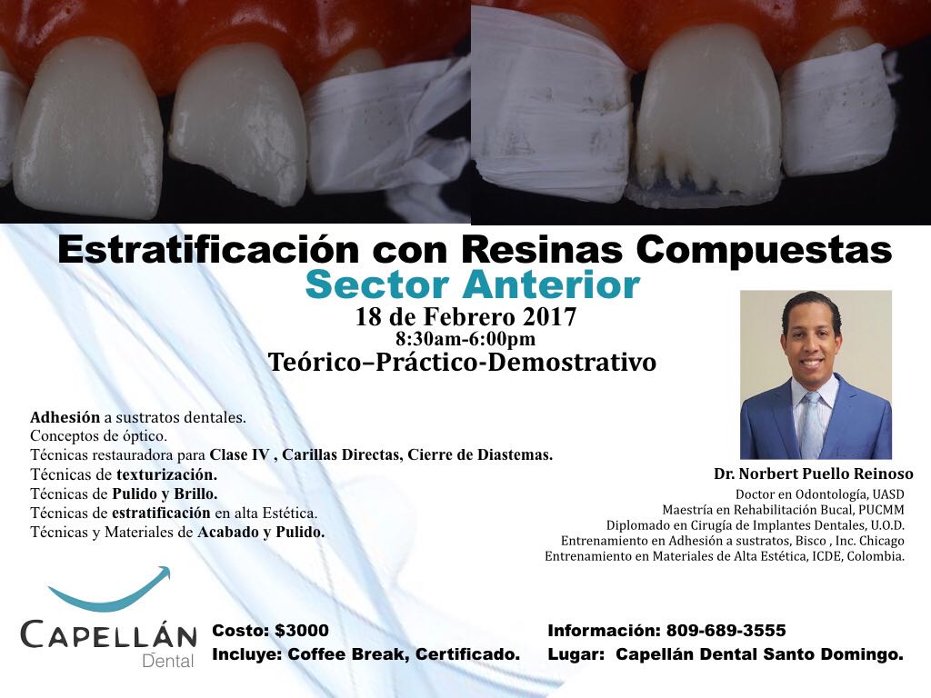 Estratificación con Resinas Compuestas