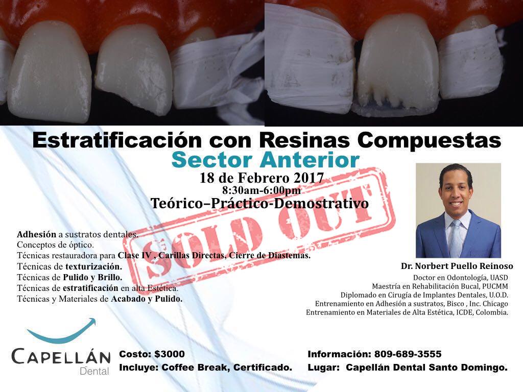 SOLD OUT Estratificación con Resinas Compuestas